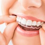 What's New In Dental Braces