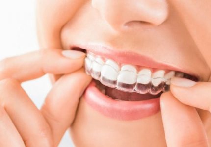What's New In Dental Braces